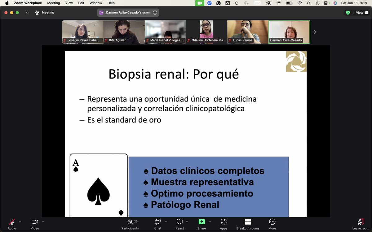 jopelina's tweet photo. Patología Renal BootCamp con @kidneypathology @bmc_nefropato #DraMontero @DraSumire #womeninrenalpathology 🙋🏻♀️👑 Casas #Podocitos #Complemento #Semilunas #Depositos @GlomConILA @GlomCon https://t.co/OUdktef5Ju