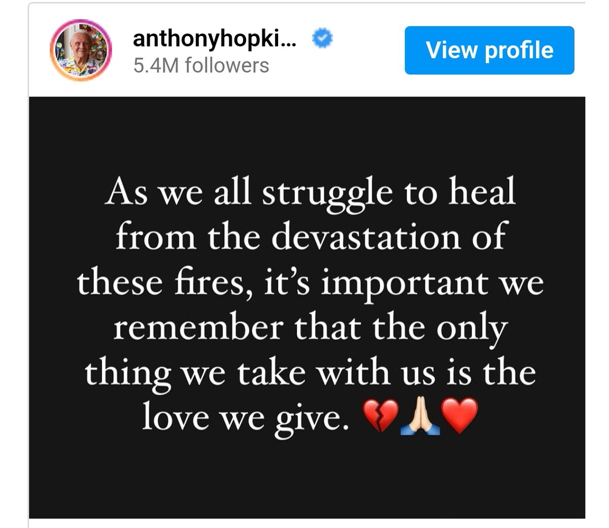 AnimeAlchemy24's tweet image. Anthony Hopkins