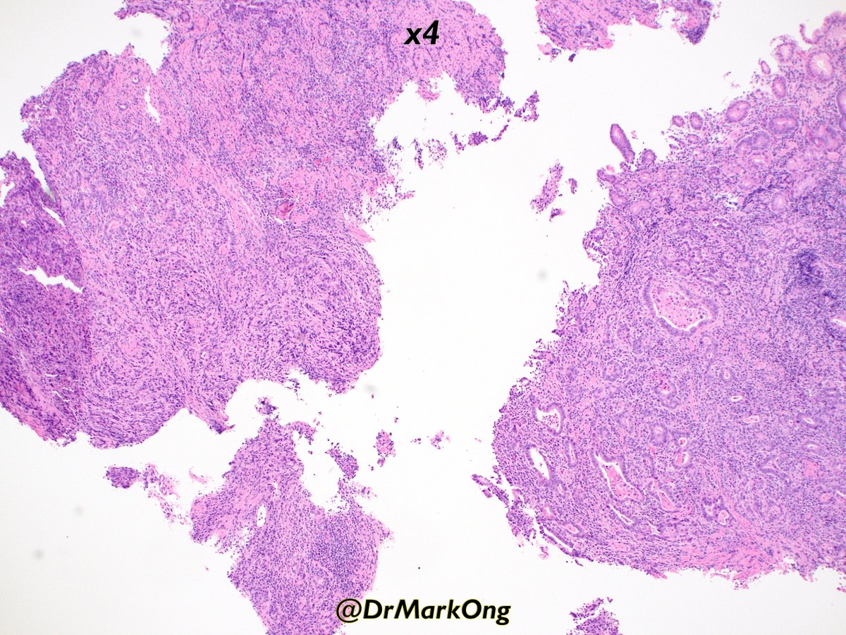 Mark Ong tweet media