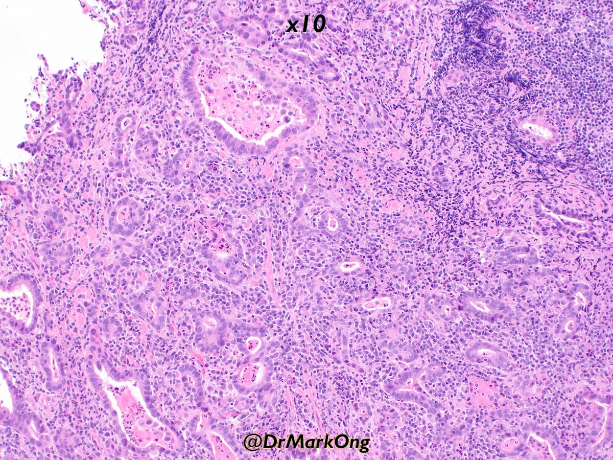 Mark Ong tweet media