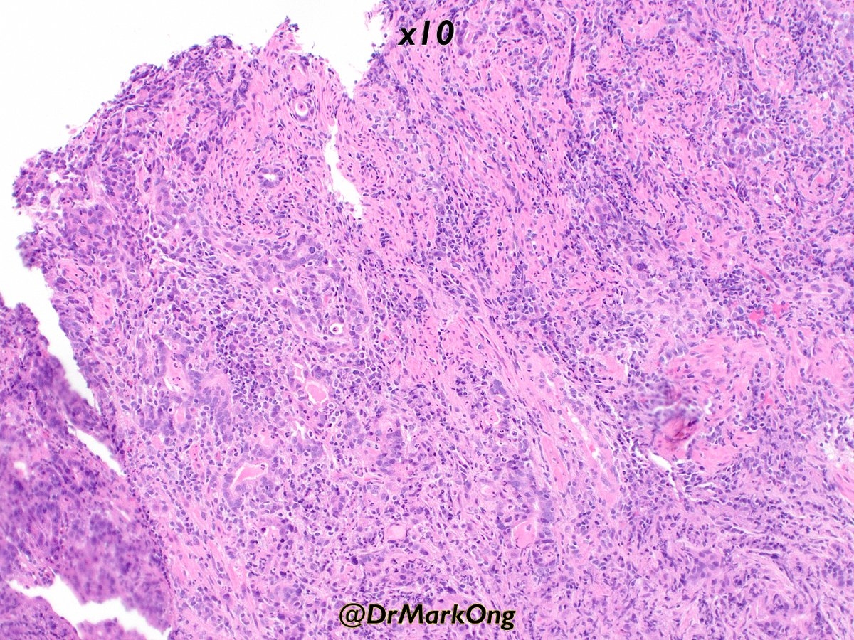 Mark Ong tweet media