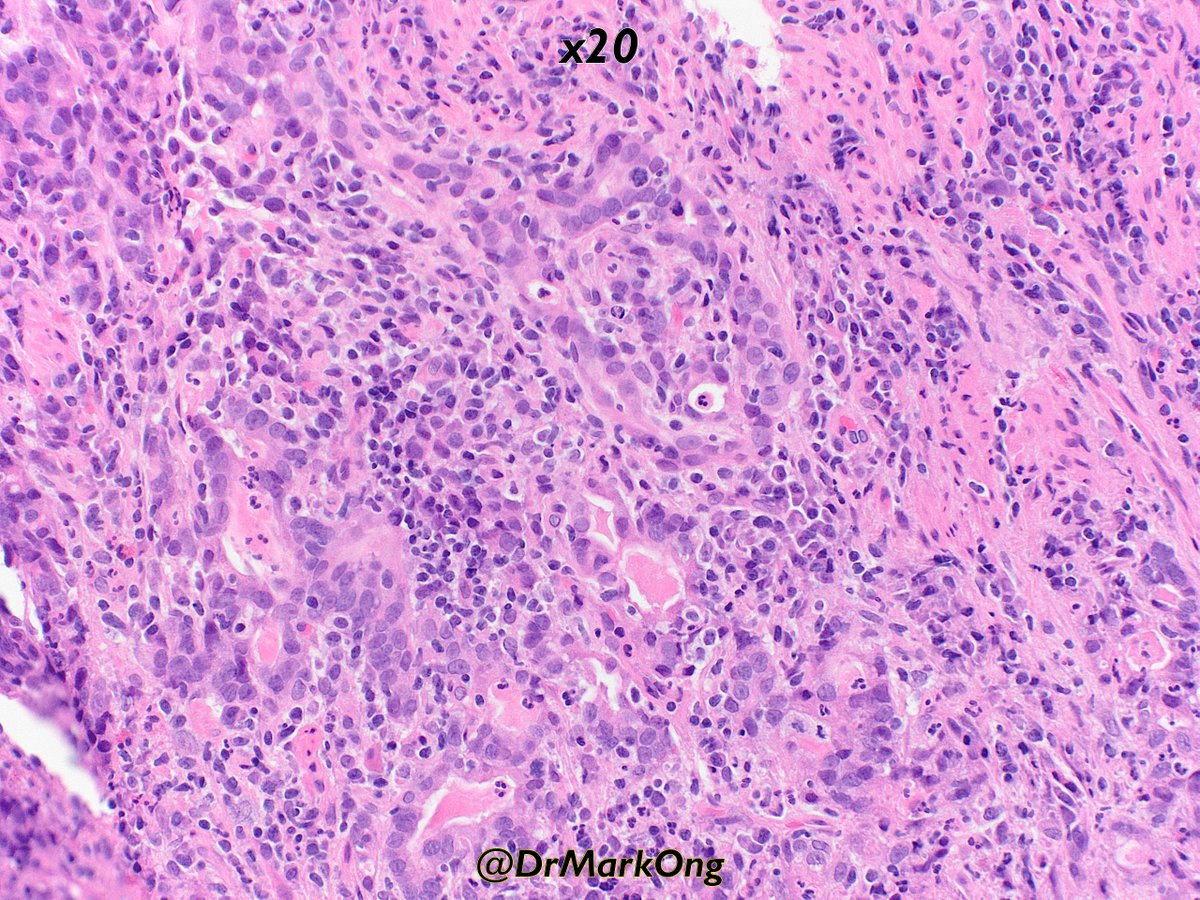 Mark Ong tweet media