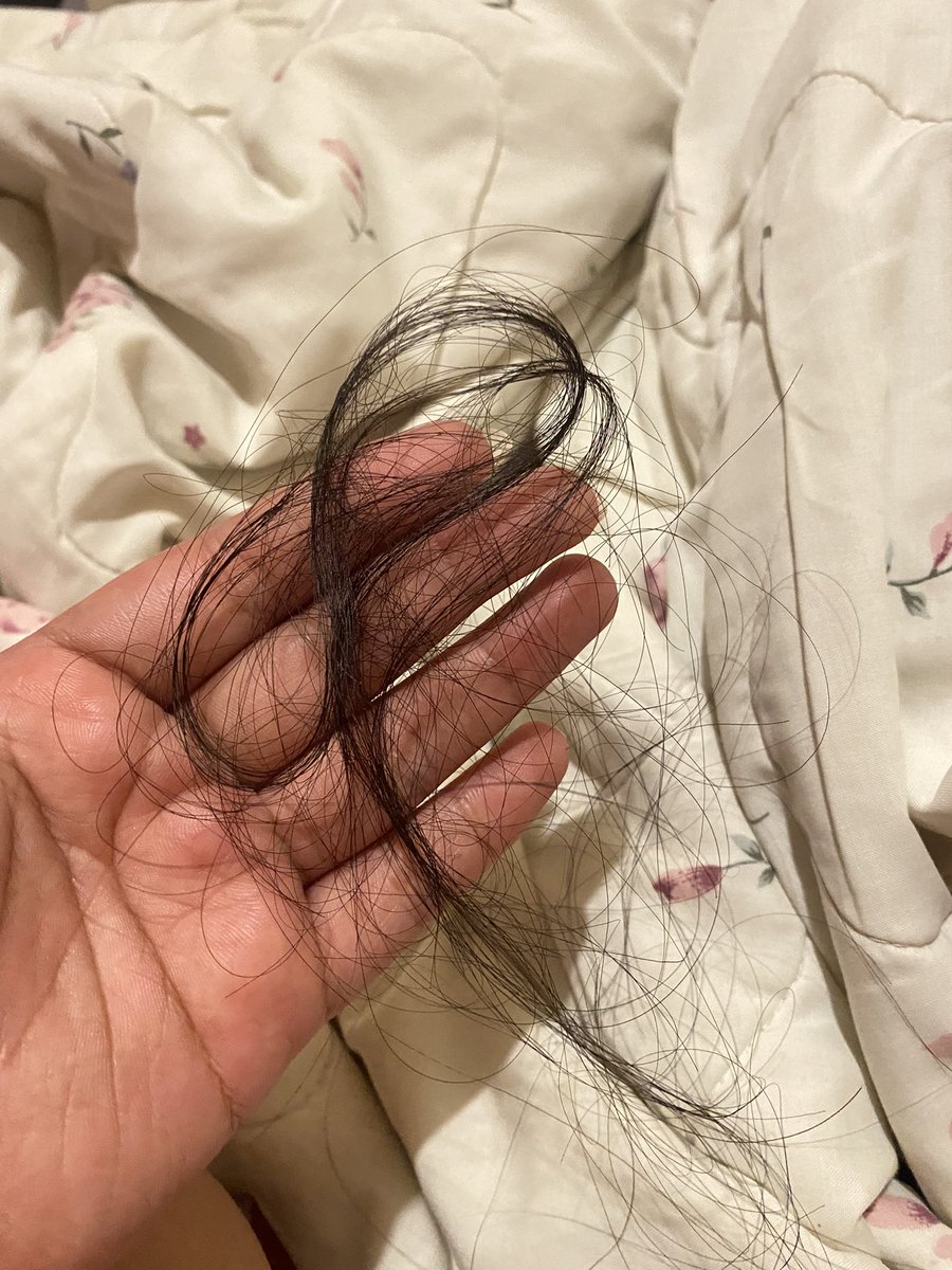 jukyumist's tweet photo. temen-temen yang belum tidur.. boleh kasih saran ngga hair care apa yang bagus untuk rambut rontok? dan mungkin ada ga lifestyle yang harus dilakuin untuk ngurangin rambut rontok? capek banget tiap nyisir pake jari rontoknya sampe segini, would be worse kalau nyisir pake sisir :( https://t.co/DSua6n26RC