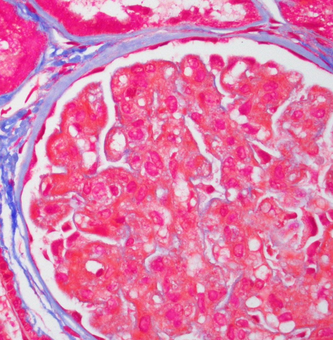 Jonathan Zuckerman MD PhD tweet media