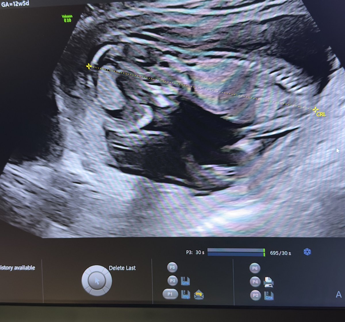 ريـمـان tweet media