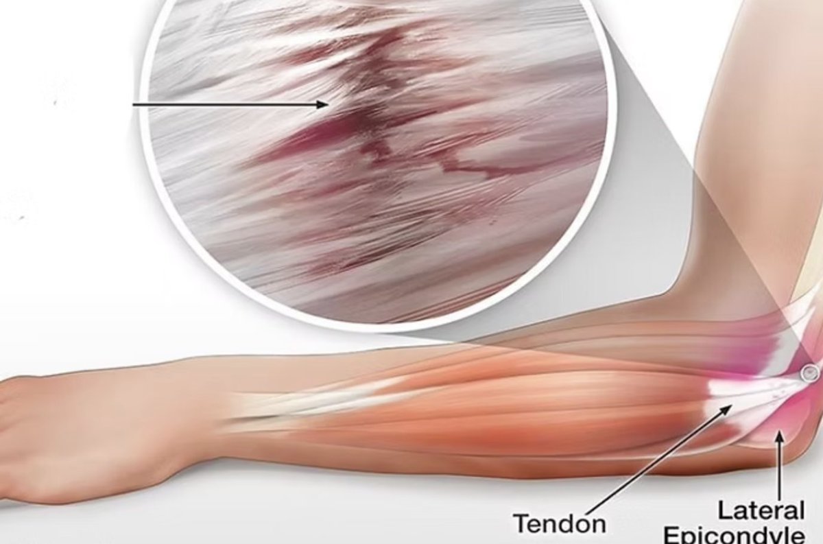 Rob - Fit For Life - Stronger Every Decade tweet media