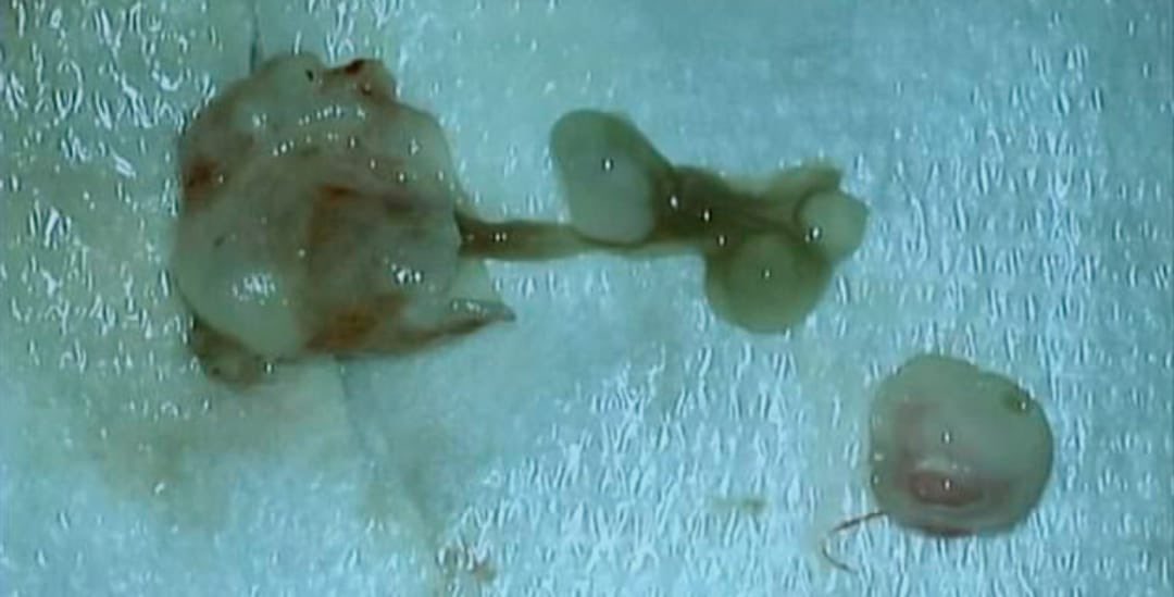 طومسون tweet media