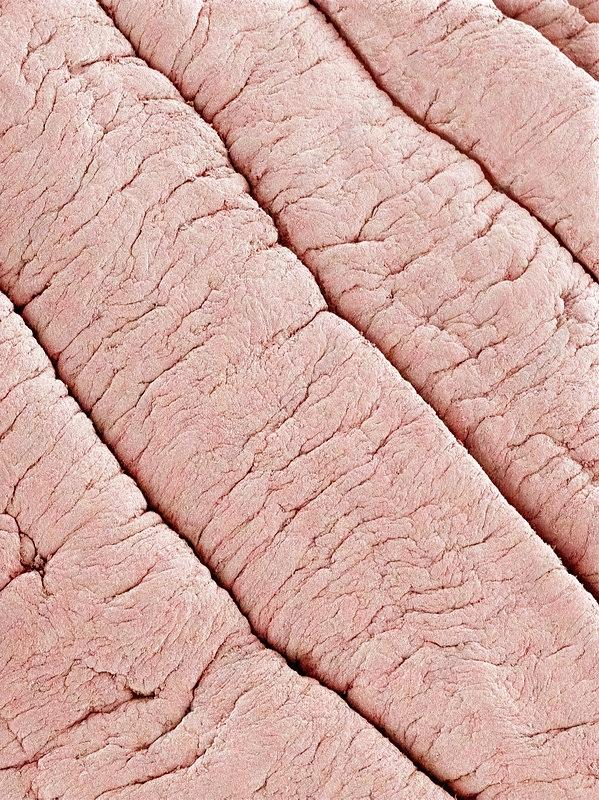 HEre's a microscopic image of a vag