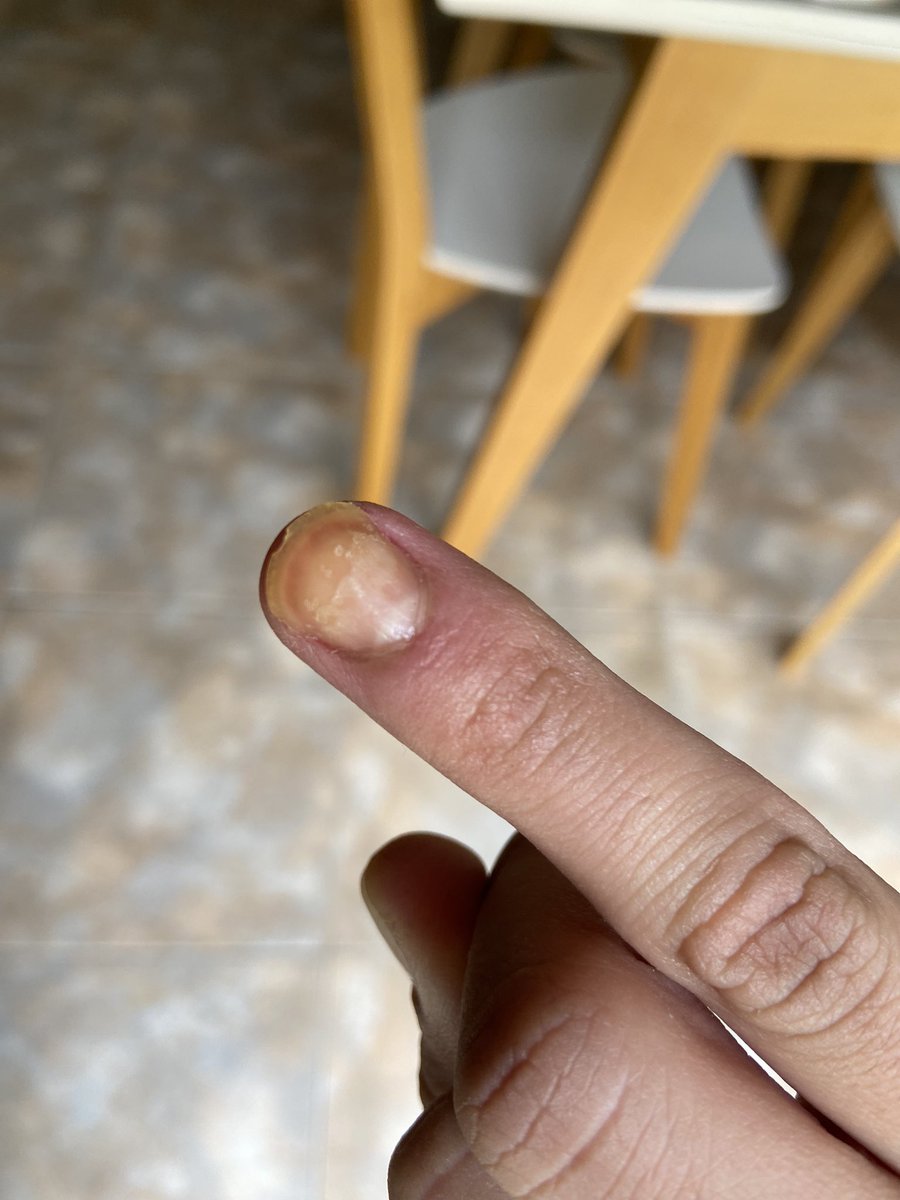 Usar soda cáustica para limpiar sale mal 🥲🥲🥲