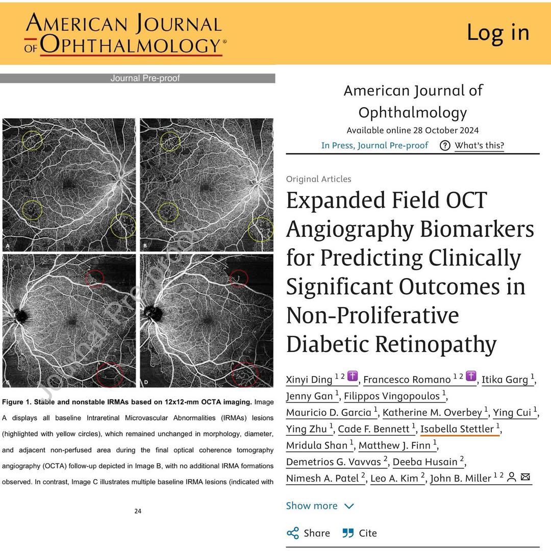 Itika Garg, MD (@itikagarg) on Twitter photo Our work demonstrates the use of expanded field #sweptsourceocta imaging biomarkers like #unstableIRMA and #nonperfusionareas in predicting clinically significant outcomes in #npdr <a href="/AJOphthalmology/">American Journal of Ophthalmology</a> <a href="/JohnBMillerMD/">John B. Miller</a> <a href="/HMSeye/">Harvard Ophthalmology</a>
ajo.com/article/S0002-…
#retina #ophthalmology #DR Our work demonstrates the use of expanded field #sweptsourceocta imaging biomarkers like #unstableIRMA and #nonperfusionareas in predicting clinically significant outcomes in #npdr <a href="/AJOphthalmology/">American Journal of Ophthalmology</a> <a href="/JohnBMillerMD/">John B. Miller</a> <a href="/HMSeye/">Harvard Ophthalmology</a>
ajo.com/article/S0002-…
#retina #ophthalmology #DR