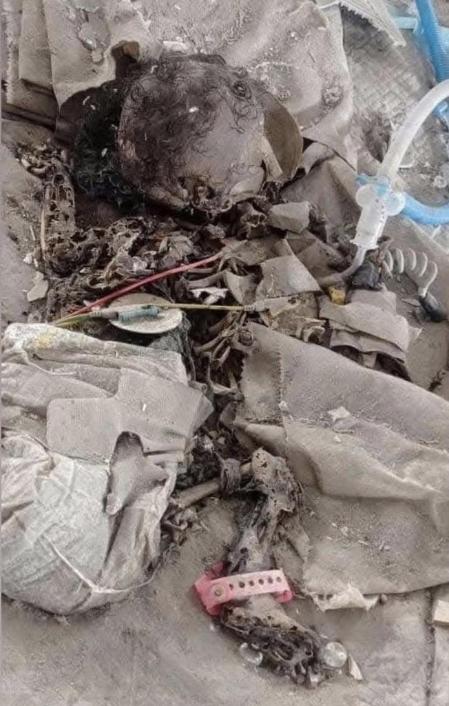 Natal ICU unit in a hospital in you know where.

#BMW #Mercedes #AUDI #VW #VivianDsena𓃵 <a href="/realDonaldTrump/">Donald J. Trump</a> <a href="/DonaldJTrumpJr/">Donald Trump Jr.</a> <a href="/IvankaTrump/">Ivanka Trump</a> <a href="/SenateGOP/">Senate Republicans</a> <a href="/SenateDems/">Senate Democrats</a> <a href="/UKParliament/">UK Parliament</a> #حرائق_كالفورنيا #AIArtwork #Braun2025 <a href="/Europarl_EN/">European Parliament</a> 
<a href="/maggieNYT/">Maggie Haberman</a> <a href="/katieglueck/">Katie Glueck</a> <a href="/peterwalker99/">Peter Walker</a> <a href="/murpharoo/">Katharine Murphy</a> 

👇