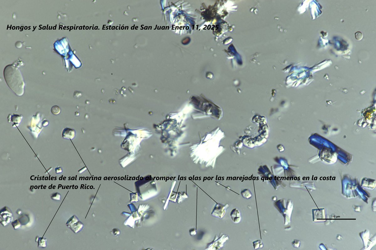 Hoy se detectaron cristales de Sal marina a través de laminilla observada en el Recinto de Ciencias Médicas. Energía de olas rompientes entre 12 a 15 pies en la costa del Atlántico. Hacia el horizonte se percibió brumoso.
