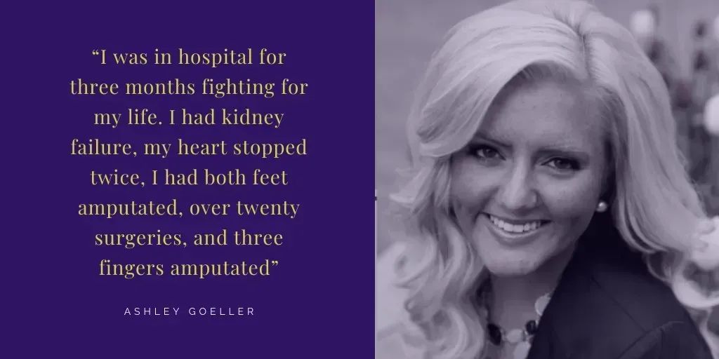 Ashley was a college freshman when she fell ill with flu-like symptoms. Sadly, what she thought was a mild flu was far more serious, Ashley caught Meningitis. Read how the disease changed her life, and about what you can do to protect your children: hoosiersvaccinate.org/ashleys-surviv…