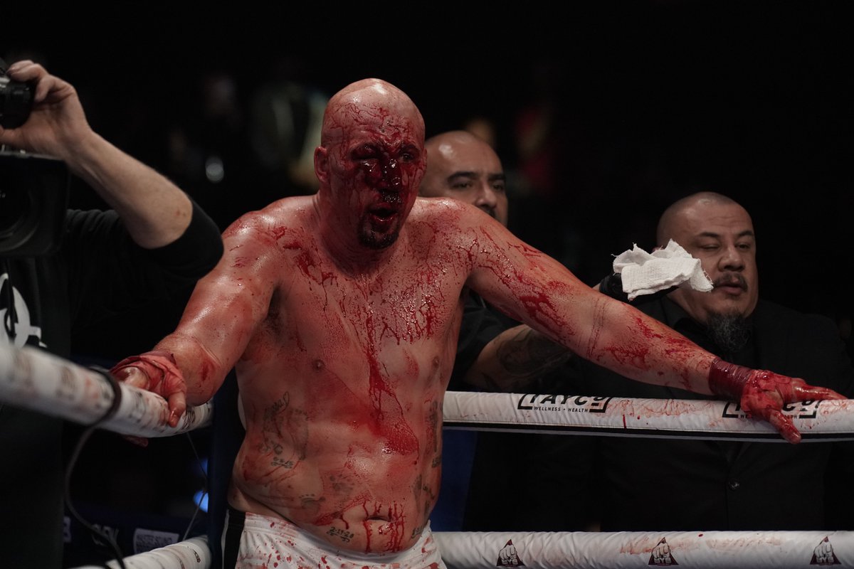 bkbbareknuckle's tweet photo. So you want to be a bare knuckle fighter?
#BYB35 #BYBExtreme #BareKnuckle https://t.co/aZ4KCIr1ow