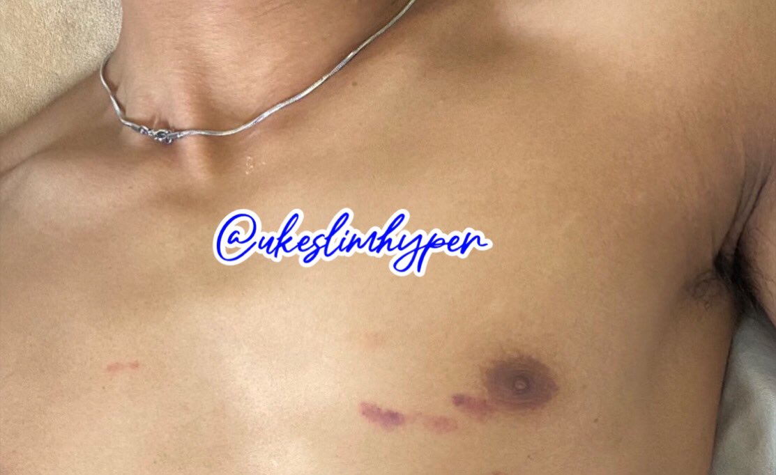 ukeslimhyper tweet media