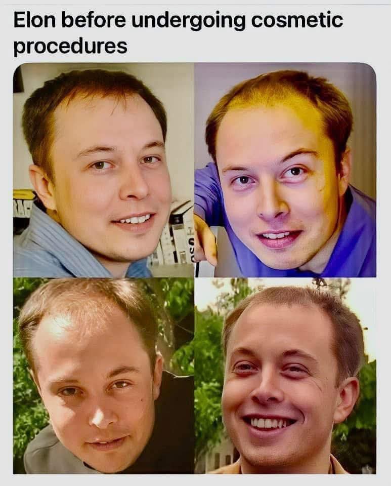 67BMXdad's tweet photo. What happened to #elon https://t.co/Ca8OidjnwD