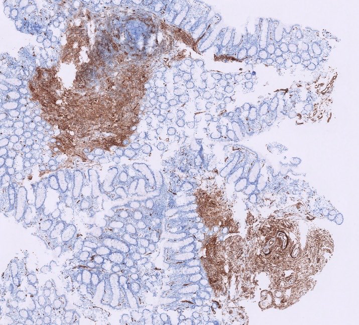 Begüm, MD tweet media