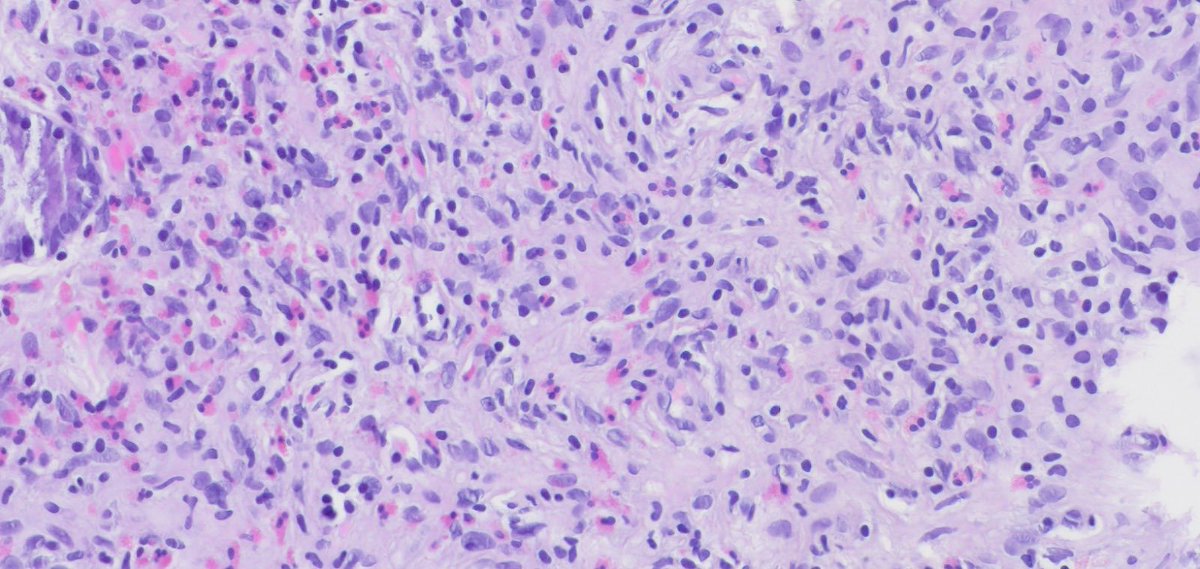 Begüm, MD tweet media