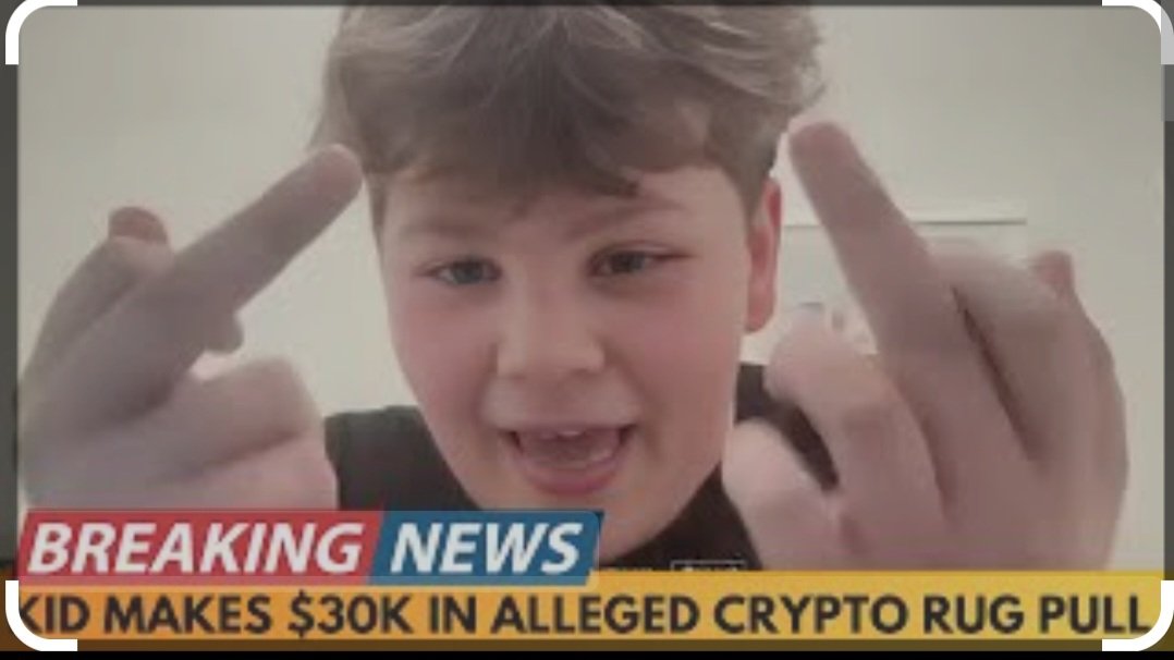 I see many similarities between them. You are a complete source of shame. <a href="/TrustProtocolAI/">Trust AI</a> $trust