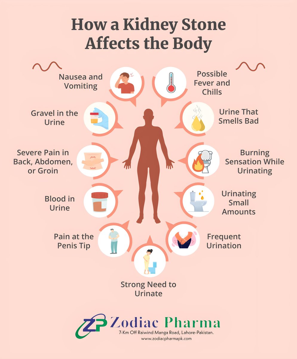 ZODIACNEWSPK's tweet photo. Kidney stones are clusters of crystals that form from minerals and other substances in your urinary tract. Most stones pass out of your body in your pee on their own, but they can be very painful.
 #nutraceuticals #pharmaceutical #medicine #zodiacpharma #kidneystone https://t.co/MTlhnha4ui