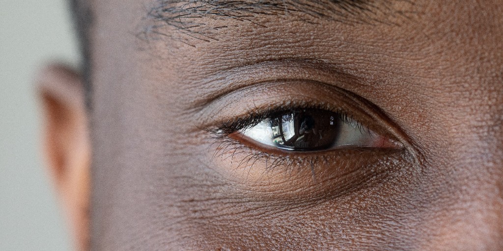 🚨 CMG Update 🚨

The following Clinical Management Guidelines (CMGs) have been reviewed and updated: 

☑️ Corneal transplant rejection 
☑️ Conjunctival pigmented lesions

College Members can log in to their account to view the changes ➡️ coptom.uk/CMGs