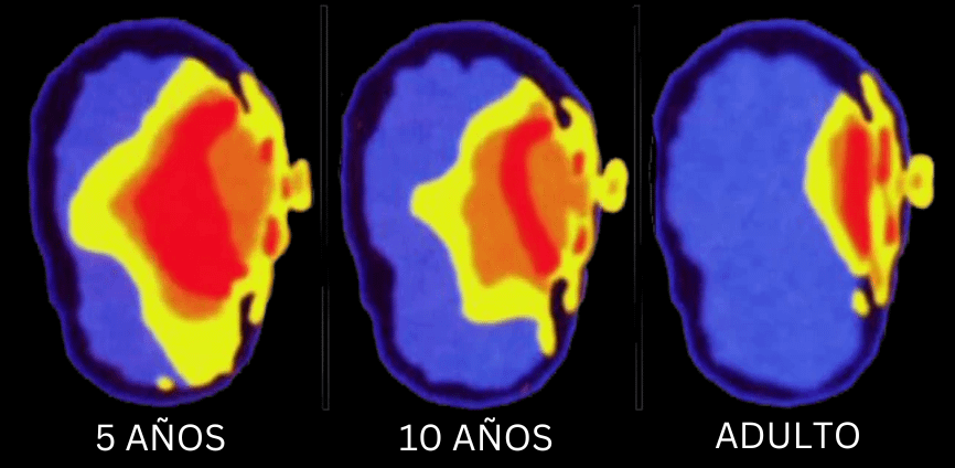 MindBodyIsLife's tweet photo. Los smartphones están encogiendo tu cerebro.

El resultado? Te estás volviendo deprimido, demente y literalmente más tonto.

Aquí te explico exactamente qué le pasa a tu cerebro y cómo puedes solucionarlo antes de que sea demasiado tarde (basado en ciencia): 🧵 https://t.co/Q4IyhVtTNK
