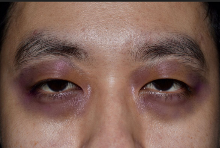 ninja_smle's tweet photo. Hello! Today, let's engage in an important discussion about head trauma, a topic that affects many lives and deserves our attention. https://t.co/wL7ODqZzAp