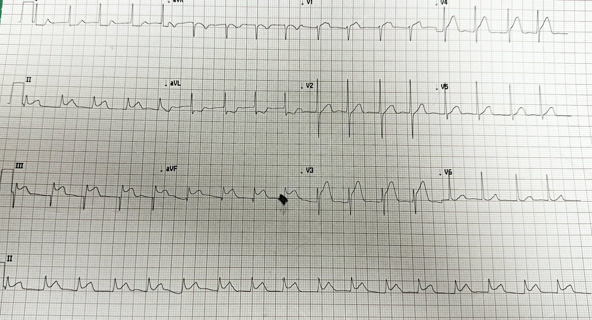 jedicath աǟզǟʀ.ǟɦʍɛɖ tweet media