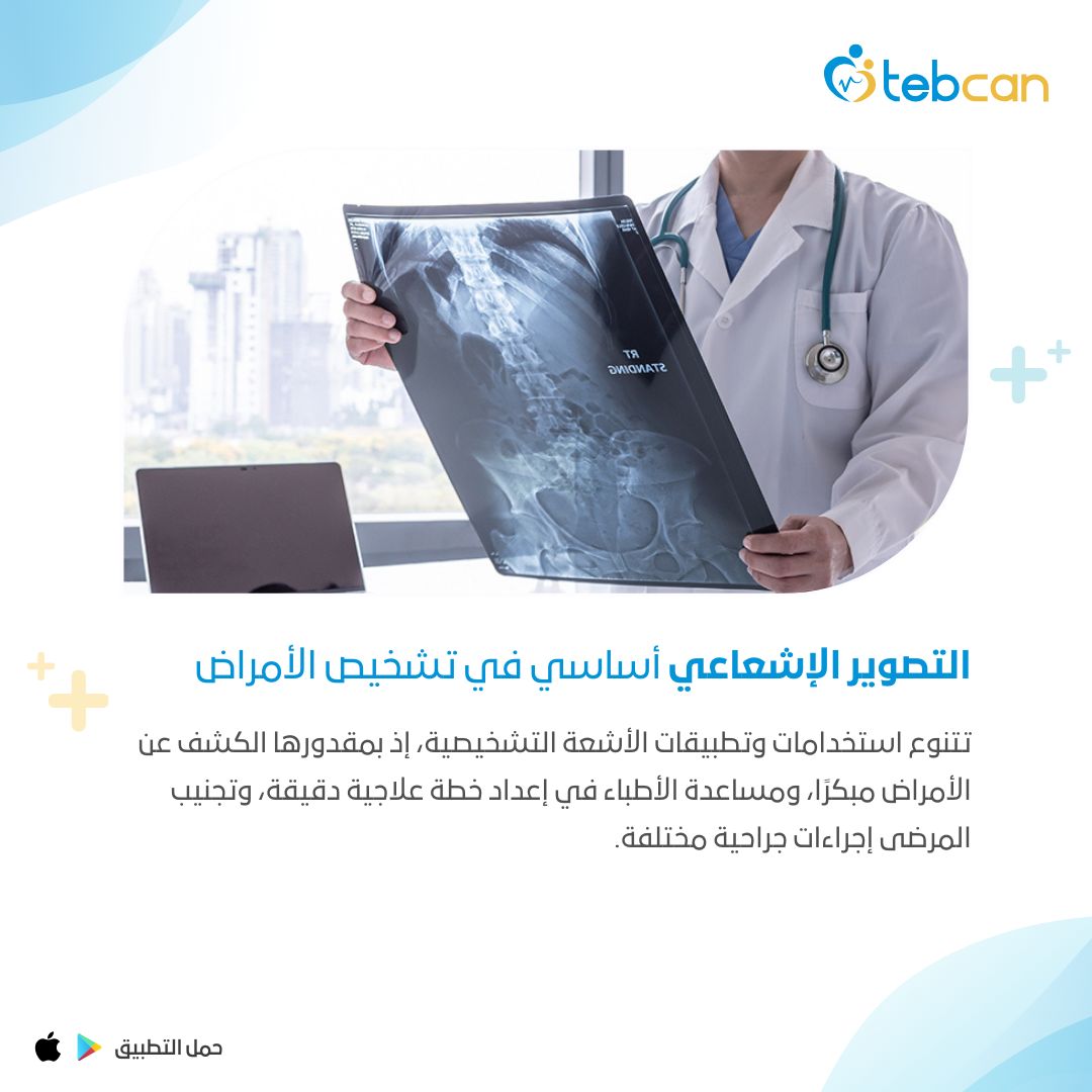 tebcan's tweet photo. 🔹أدّى اكتشاف الأشعة السينية سنة 1895 مبلادي إلى ثوة في عالم الطب التشخيصي على جميع الأصعدة، إذ مكّن الأطباء من تشخيص، وتقييم، وعلاج مختلف الأمراض والإصابات بدقة متناهية، خصوصًا الطارئة منها والتي تستوجب الإجراءات السريعة لإنقاذ حياة المريض.
للمزيد عبر الرابط التالي :
https://t.co/m62xLnXMLA
#طبكان #تصوير #أشعة #أطباء