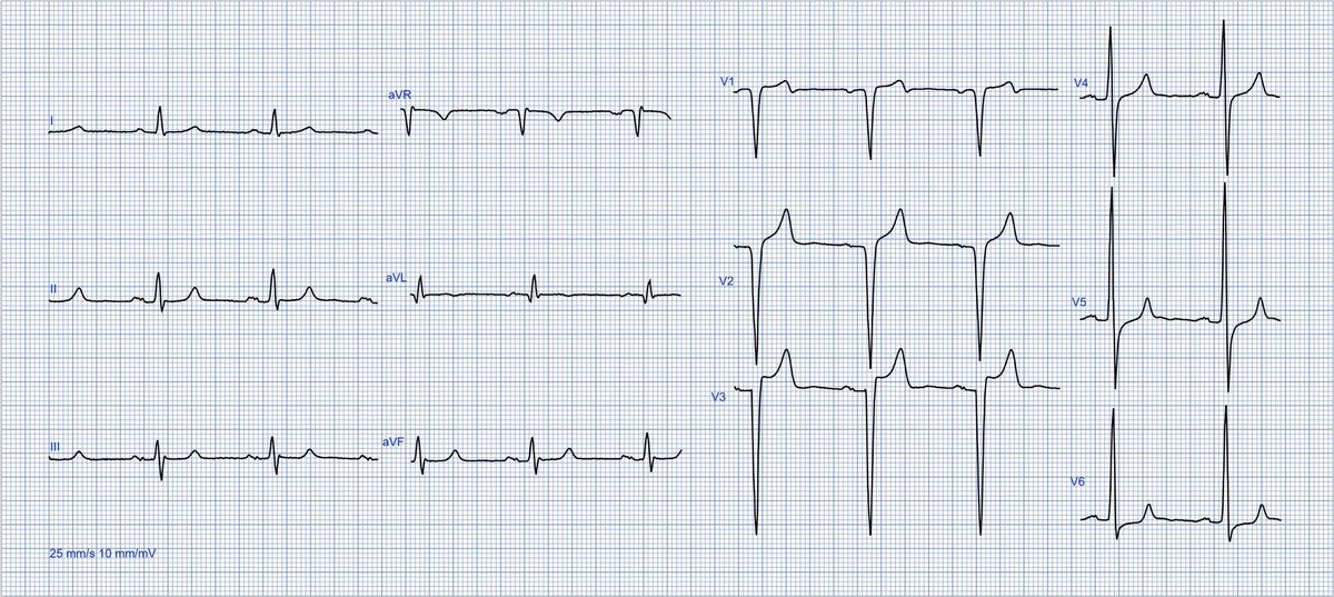 Dr. Andreas Roeschl tweet media