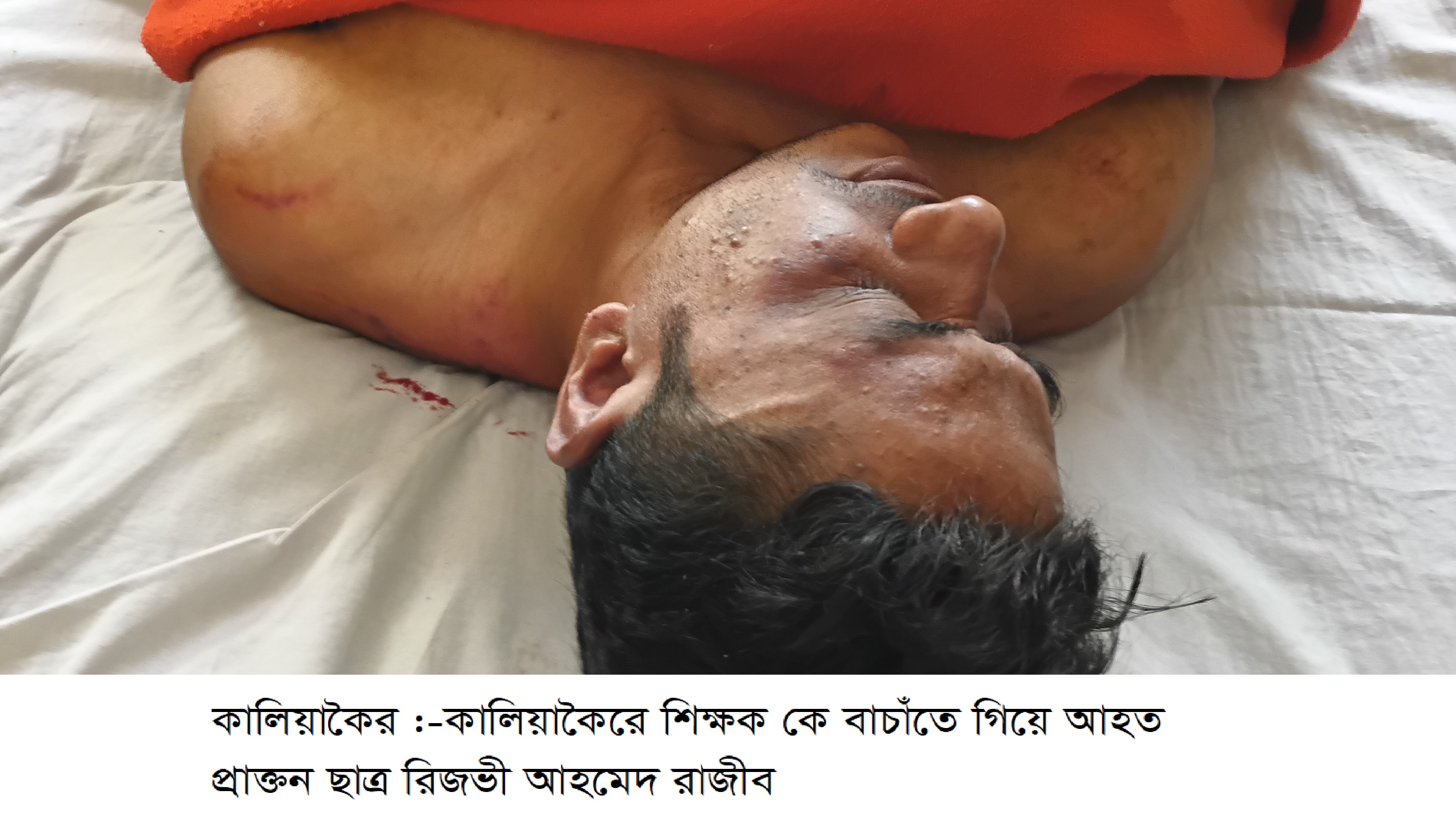 কালিয়াকৈরে বিদ্যালয়ের শিক্ষককে মারধরের অভিযোগ