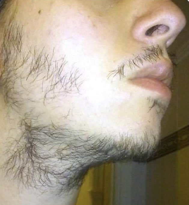 “Hey bro check your DM I got real alpha for you”