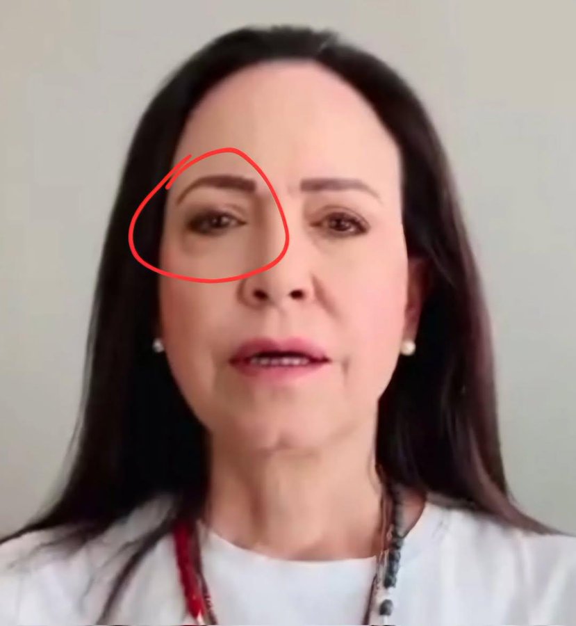 SonPolemicas's tweet photo. "Mami los Chavistas me pasaron un bicho así por la cara el 10 de Enero y se me hinchó el ojo..." https://t.co/FC8o2RMcLl