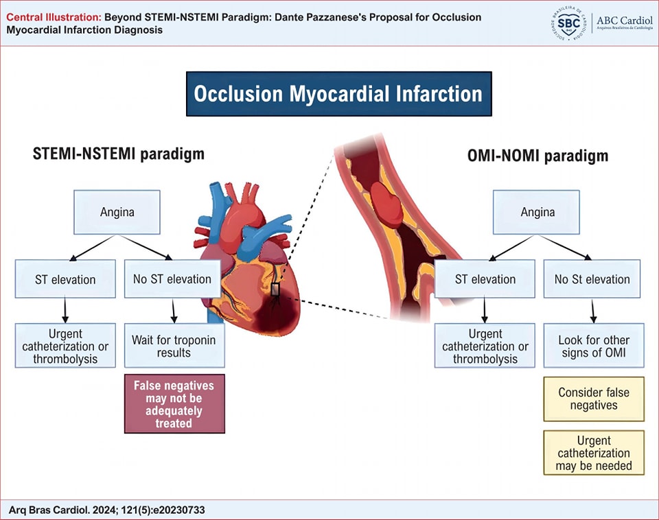 ZHeart11768530's tweet photo. 🔴Beyond STEMI-NSTEMI Paradigm: Occlusion MI Diagnosis⤵️ #2024Review #openaccess 

🔹The new paradigm: OMI-NOMI
🔹https://t.co/XKgCR1st0z 
 #Cardiology #FOAMed #MedEd #medstudent #paramedic #Cardiology #CardioEd #medtwitter #meded #CardioTwitter #cardiotwiteros  #MedX https://t.co/B0uY2Rn86C