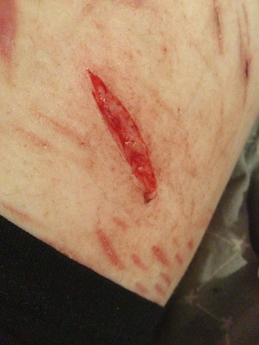 tism_eater's tweet photo. Thi is from a few days ago bc I don’t have many blades left so I’m trying not to cut as much until I can get more 💔💔 
Long baby beans!! https://t.co/Zb9z0WMIIE