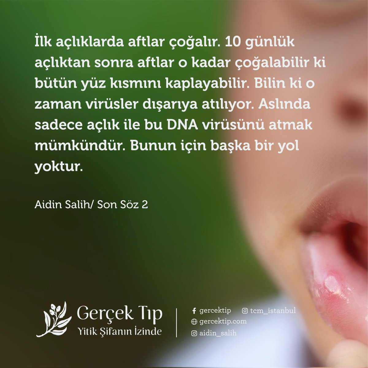 Ağızda aft çıkması çok ciddi bir hastalıktır. Çünkü aftlar insanda DNA virüsü bulunduğunun belirtisidir.Hazır yiyecek ve içecekler, yani katkılı gıdalar tüketenlerde, tıbbi ilaç ve aşı kullananlarda olur.Aslında sadece açlık ile bu DNA virüsünü atmak mümkündür. 

Aidin Salih/ SS2
