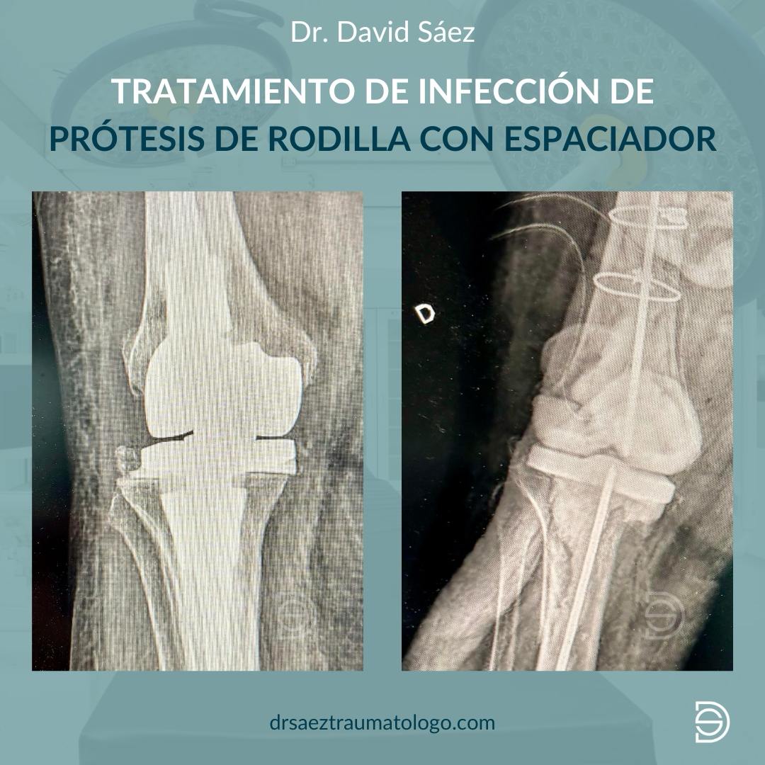 Dr. David Sáez Martínez tweet media