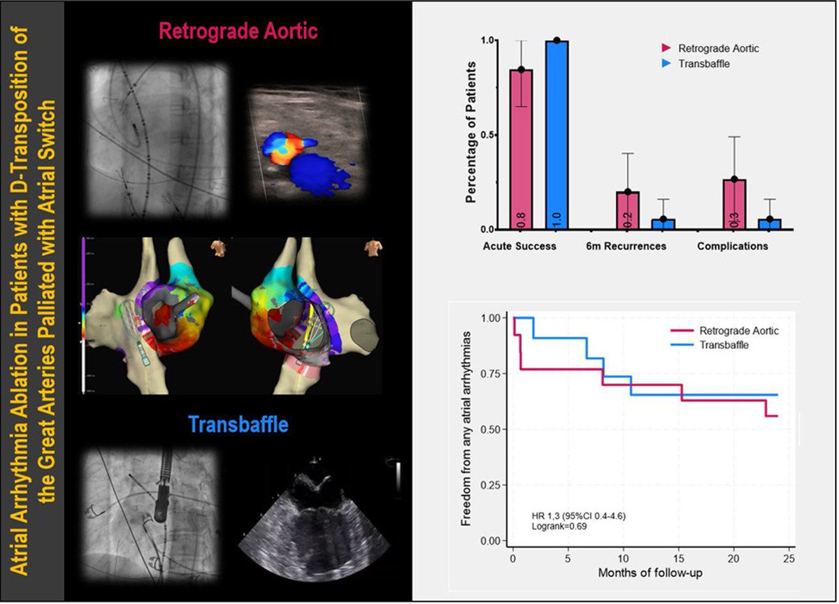 J.Francisco-Pascual (@j_francisco_ep) on Twitter photo 🎯Trans-baffle or Retrograde Aortic Approach for Atrial Arrhythmias Ablation in Patients with D-Transposition of the Great Arteries Palliated with Atrial Switch is now available at <a href="/hrs_journal/">HeartRhythm</a> #EPeeps #Cardiology #CardioTwitter #MedTwitter
bit.ly/4hdmgBq 🎯Trans-baffle or Retrograde Aortic Approach for Atrial Arrhythmias Ablation in Patients with D-Transposition of the Great Arteries Palliated with Atrial Switch is now available at <a href="/hrs_journal/">HeartRhythm</a> #EPeeps #Cardiology #CardioTwitter #MedTwitter
bit.ly/4hdmgBq