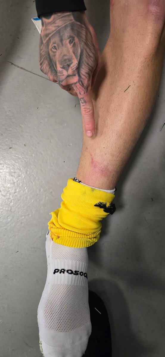 Gaules's tweet photo. Segundo a revisão do VAR o jogador da Colômbia apenas raspou no K9.. sempre foi contra tudo nós vamos pra cima https://t.co/xob5jAkuc9