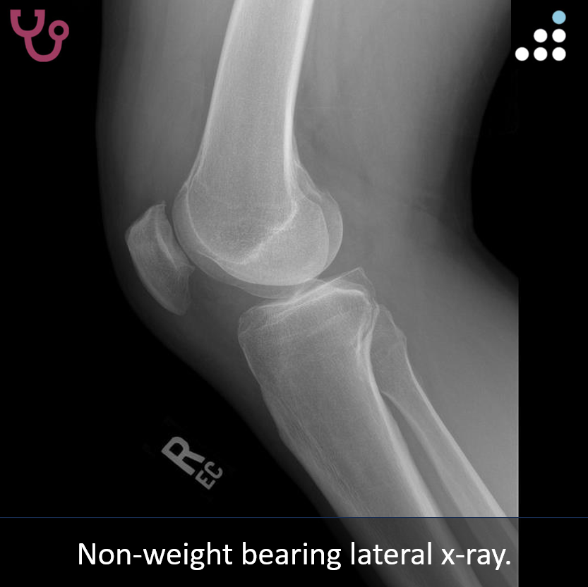 Orthobullets tweet media