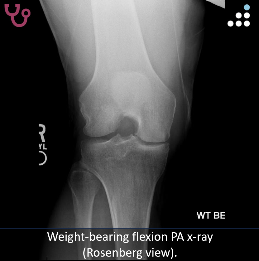 Orthobullets tweet media