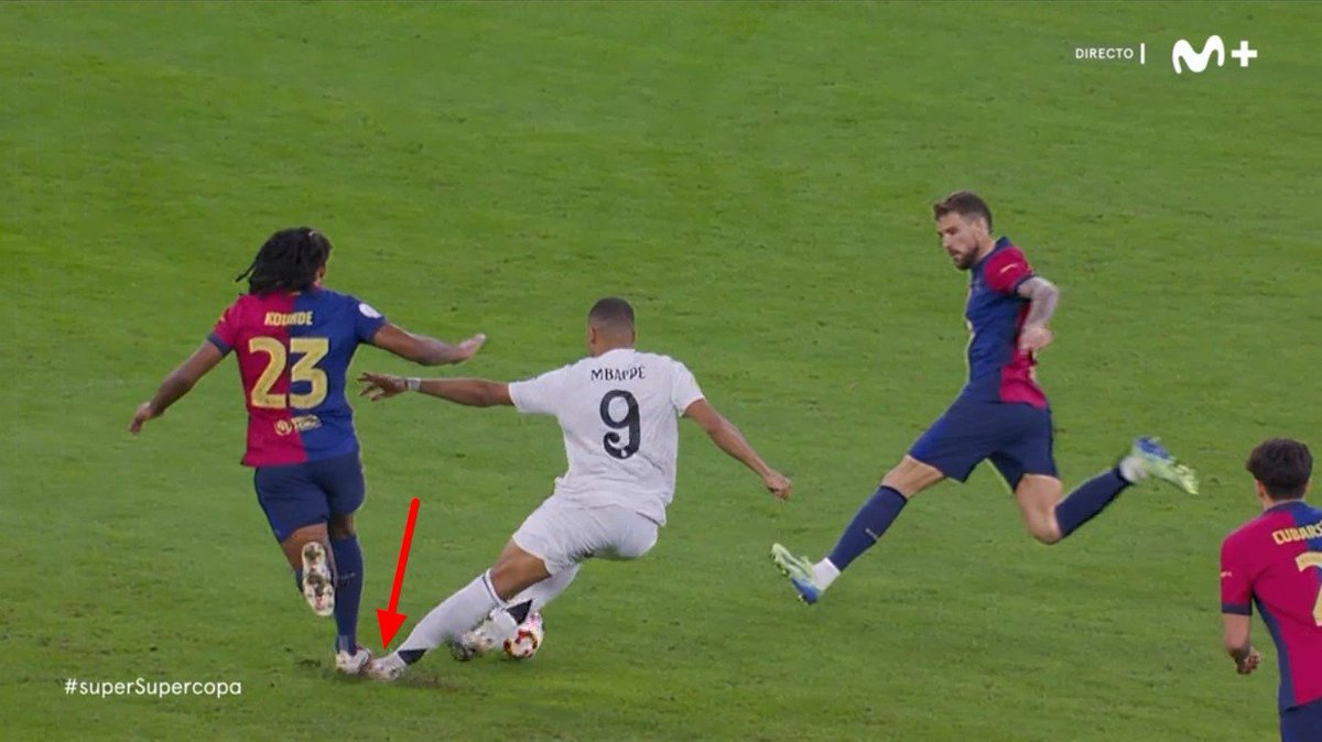 Pues se han cargado a Mbappé, ha sido el puto Koundé con este pisotón. 
Ni falta pitó Gil Manzano el "madridista", en Movistar dice Carlos Martínez que tuvo mala suerte, poco más que le puso el pie debajo al defensa del Barcelona, iros a cagar.