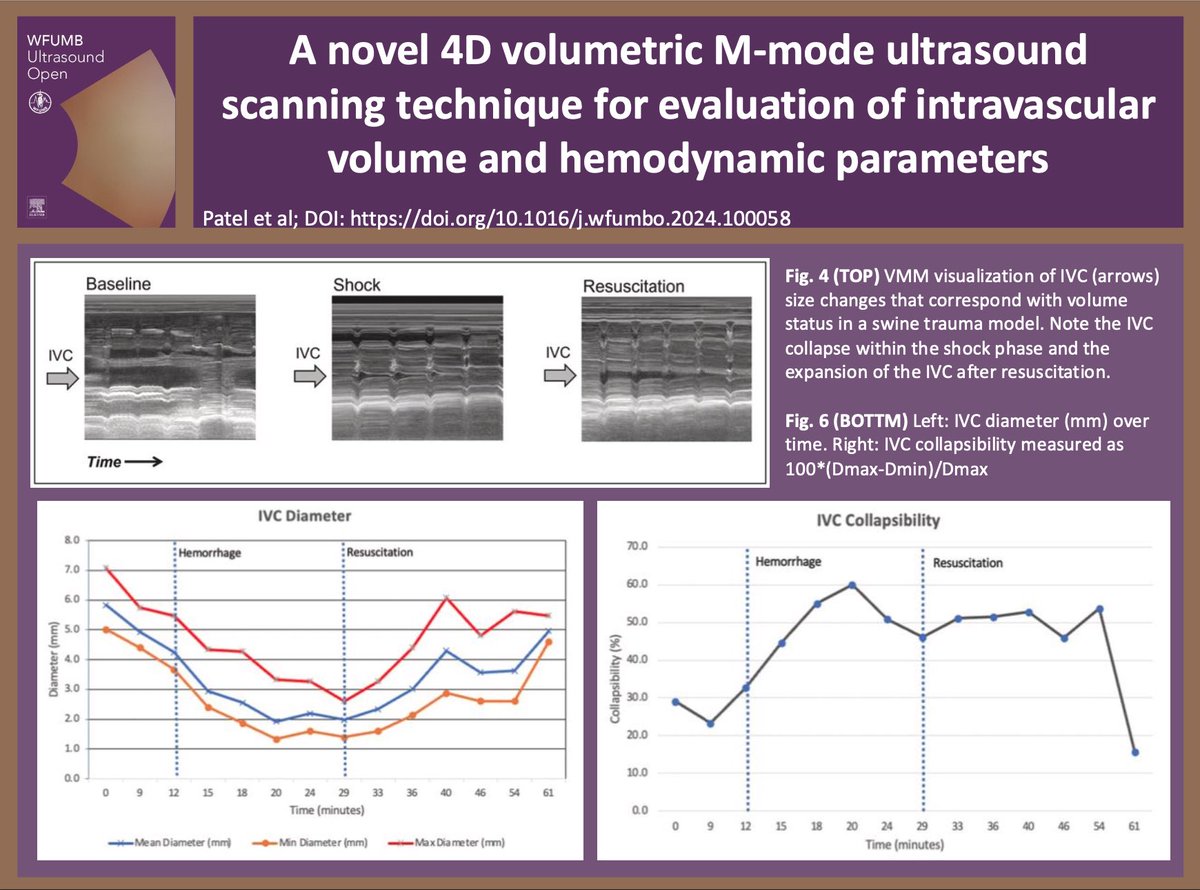 WFUMBOpen's tweet photo. 📄A #novel 4D volumetric M-mode #ultrasound scanning technique for evaluation of #intravascular volume and #hemodynamic parameters📄

Patel et al.

Read online: https://t.co/C8JupZg31T.

Submit your article: https://t.co/O4MHaNMm9u 

#WFUMB #vascular #ultrasonography https://t.co/jAoyxVoKRJ