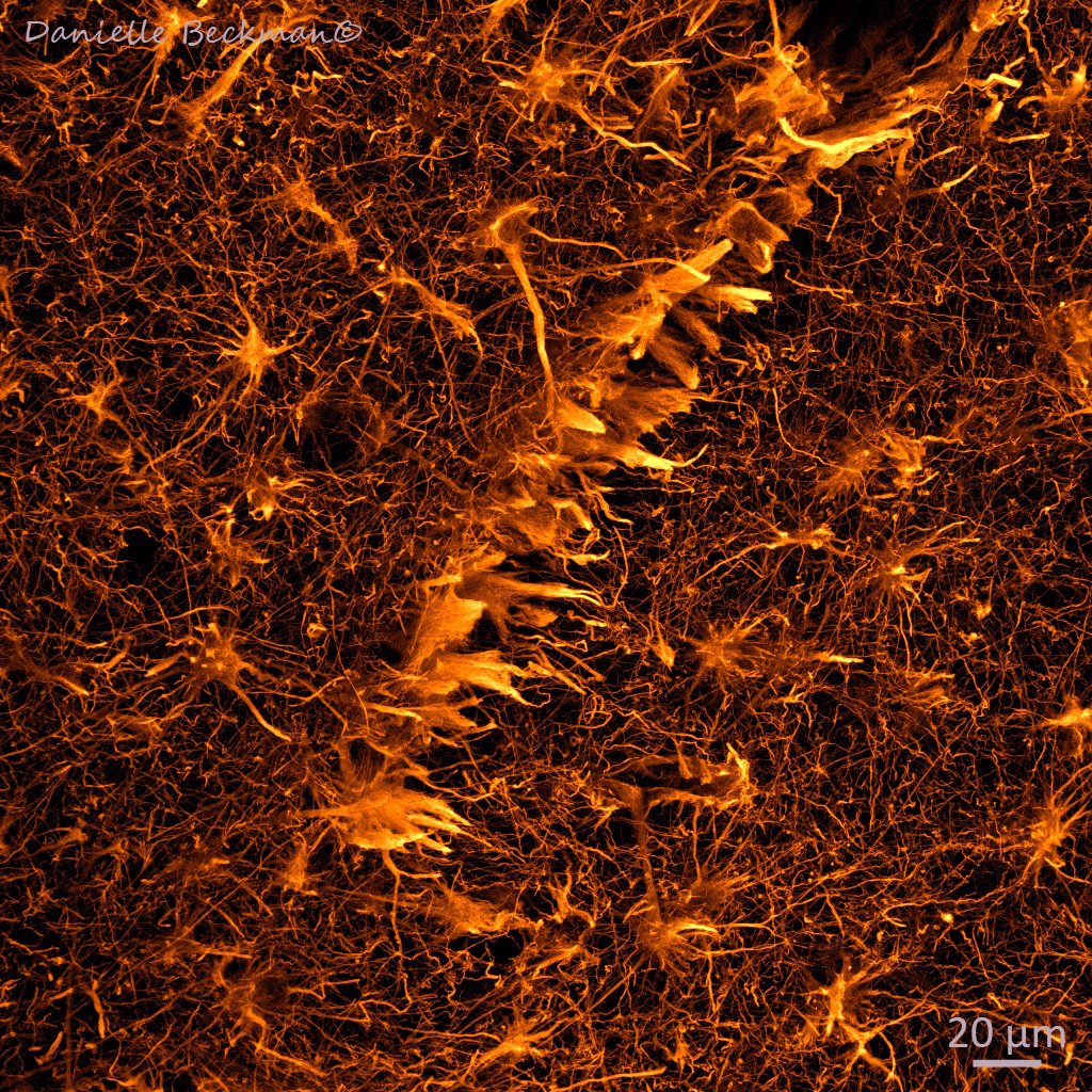 DaniBeckman's tweet photo. Neurons are cool, but astrocytes steal the show like no other cell type in the nervous system!  Check the shape of a blood vessel in the middle of the image 🔬. The brain is the most beautiful organ in the body (says my brain)🧠 https://t.co/zlQkUoFhJe