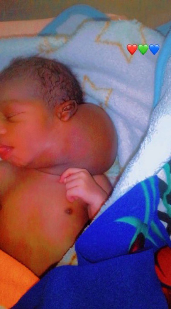 ajacoumba's tweet photo. Il souffre d’une tumeur. Aidez ce petit bébé à retrouver la santé en contribuant à ses soins. Chaque geste compte et peut faire une grande différence. Vous pouvez envoyer vos dons via OM ou Wave au numéro suivant : 769916431. Merci pour votre générosité.🆘🆘🆘 https://t.co/Cw399iP7Zf