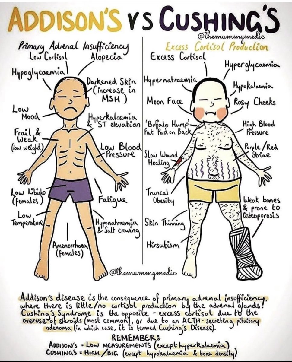 OGdukeneurosurg's tweet photo. Addison vs Cushing https://t.co/tcTyh167OH