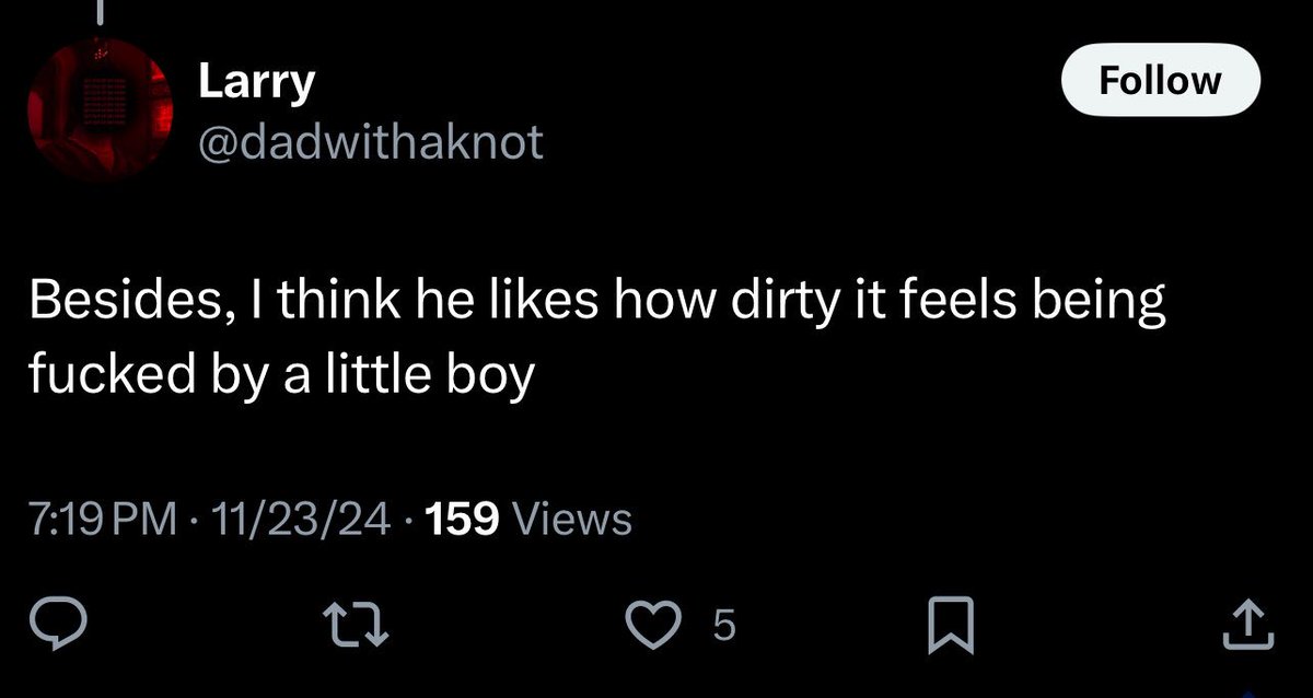 Rat (@rodentttteeth) / Posts / X