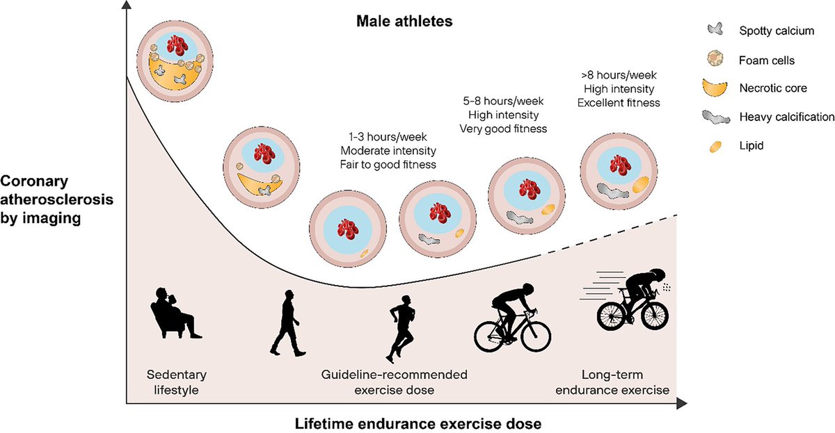 Enrique Santas (@santasenrique) on Twitter photo Aterosclerosis coronaria en atletas y deportistas. Interesante revisión en <a href="/ESC_Journals/">European Society of Cardiology Journals</a>
🔖 Mecanismos y factores asociados
🔖 Clínica e identificación
🔖Propuesta de manejo
<a href="/secardiologia/">Soc Esp Cardiología</a> <a href="/SVCardio/">SVCardio</a>
academic.oup.com/eurheartj/adva… Aterosclerosis coronaria en atletas y deportistas. Interesante revisión en <a href="/ESC_Journals/">European Society of Cardiology Journals</a>
🔖 Mecanismos y factores asociados
🔖 Clínica e identificación
🔖Propuesta de manejo
<a href="/secardiologia/">Soc Esp Cardiología</a> <a href="/SVCardio/">SVCardio</a>
academic.oup.com/eurheartj/adva…