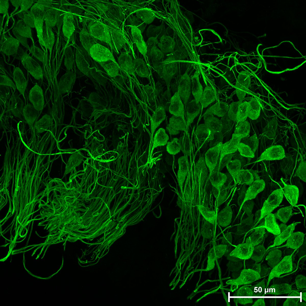 HearingShef's tweet image. Happy #MicroscopyMonday, everyone! 🎉 This week, Char shares a stunning confocal image of beta III tubulin labeling in spiral ganglion neurons from a P9 cochlea dissection. Look at those beautifully detailed somas and projections!