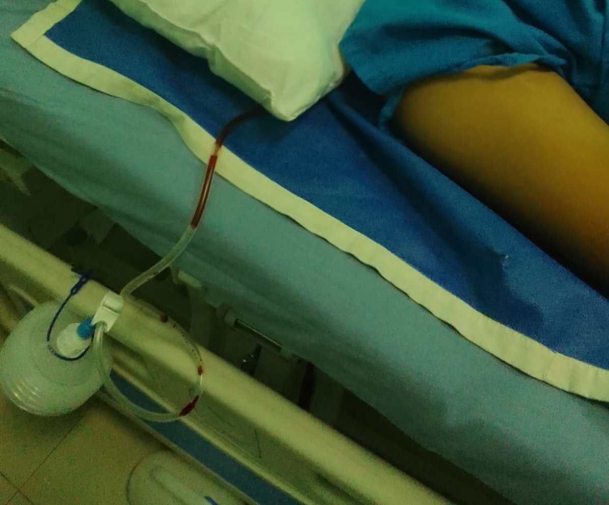 leenanafi's tweet photo. ketemu lagi nanti ya dek tanggal 25 In syaa Allah kakak kesana lagi, In syaa Allah adek udah dalam kondisi yg lebih baik ya dek, ntar kakak kesana sama centil Nurul, wkwkwk (foto abis keluar dari ruang op) https://t.co/u1Rs3CiCMk